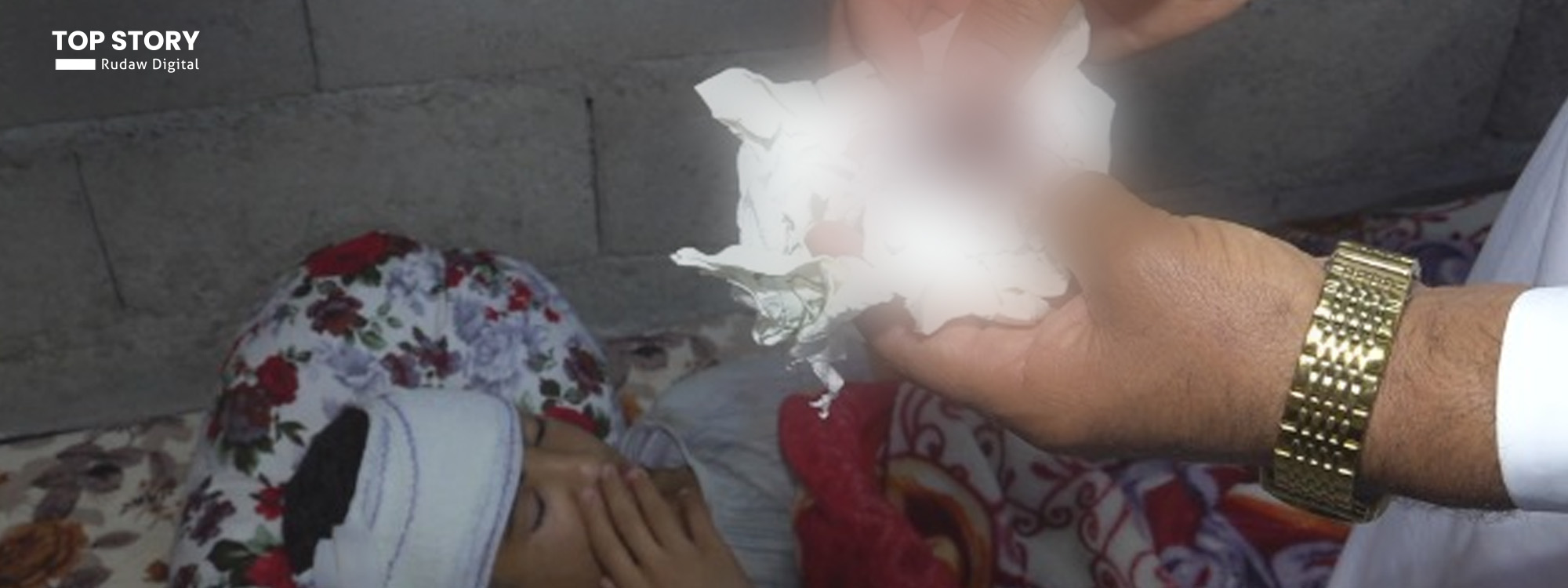 فتى في كركوك يتعرض لإصابة بليغة برأسه جراء سقوط مروحة على رأسه
