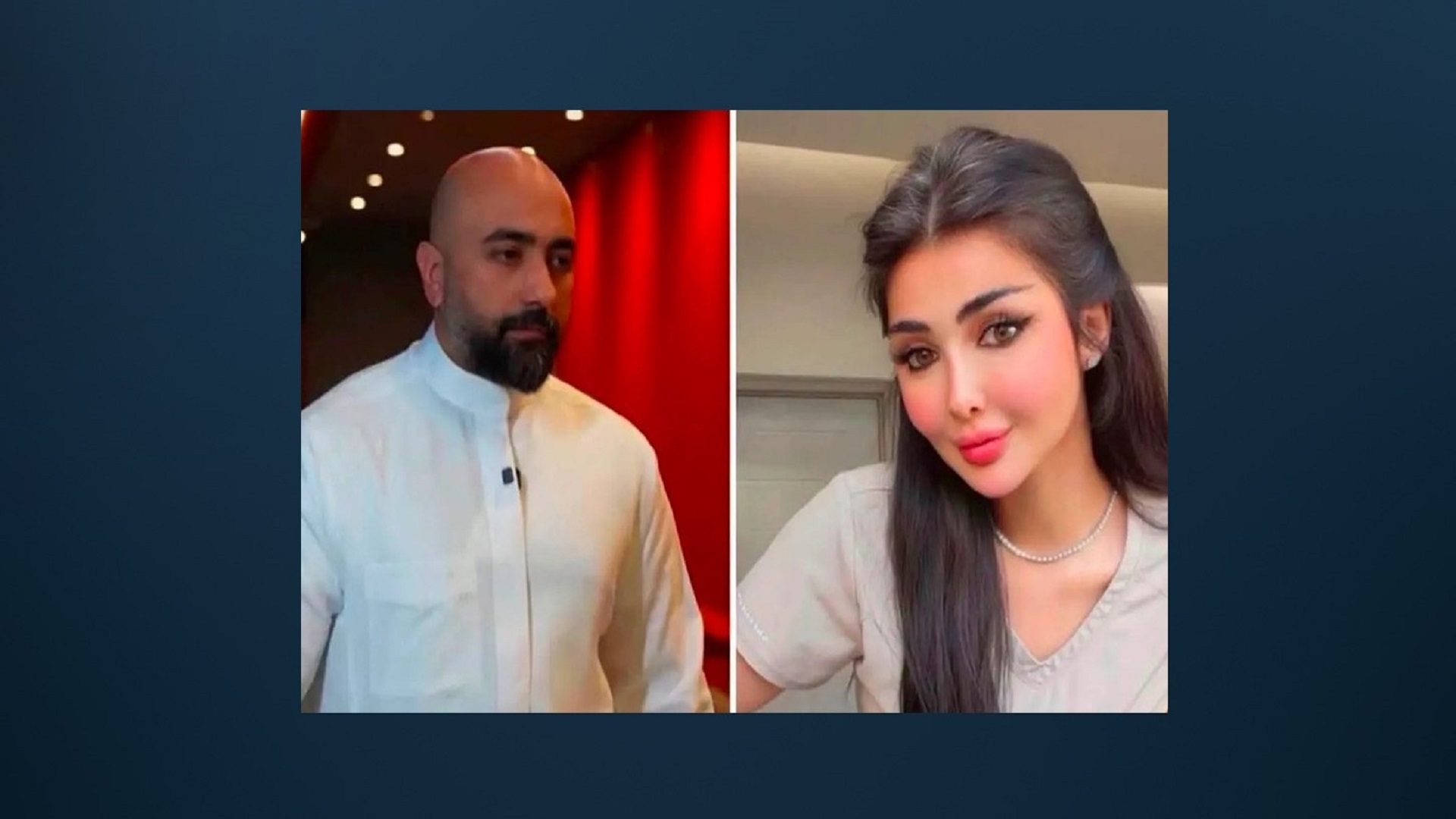 طبيب تجميل في بغداد يحرق وجه زوجته